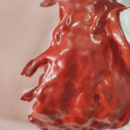 DARHMMY: Lower Limb Trauma Amputation Hemostasis Model for Medical Trauma Care