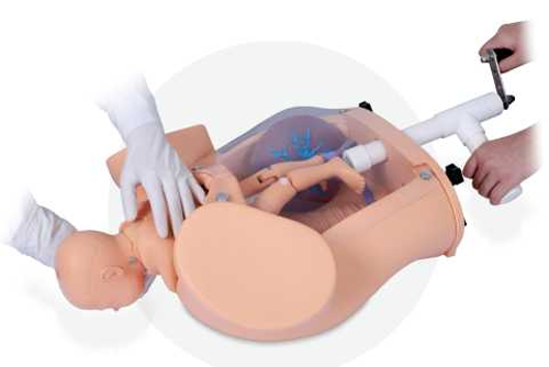 Manual Rotation Delivery Demonstration Model
