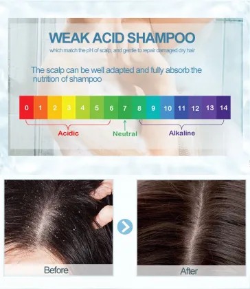 China Manufacturer Good Quality Anti-Oily Dandruff Remover Shampoo for Professional Salons