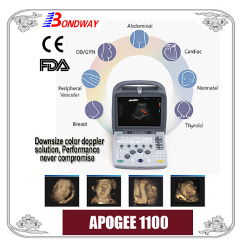 Portable Color Doppler Ultrasound (smart 4D Color Doppler ultrasound system with fashionable design 12' screen)
