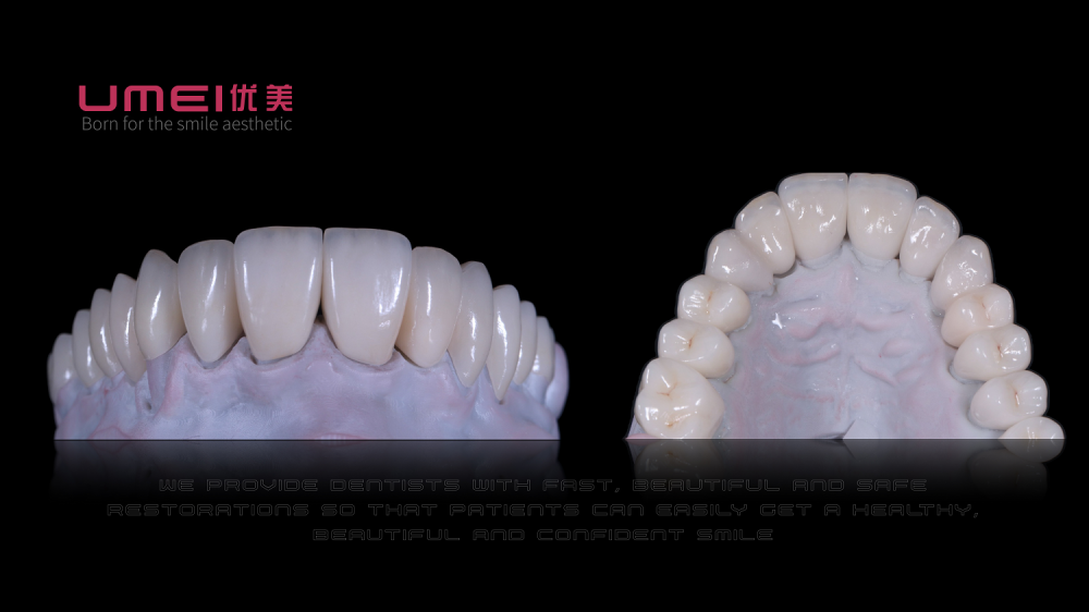 การออกแบบวีเนียร์ Veneer Design
