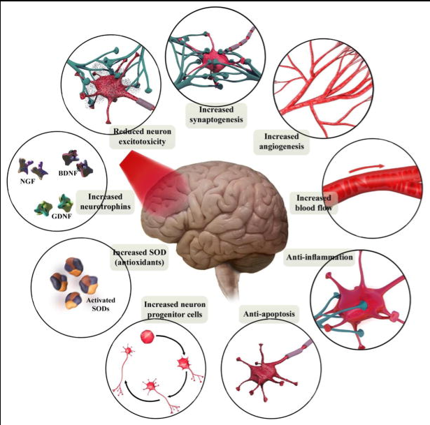 brain health care 2