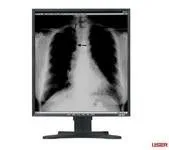 Anti-reflective Medical Grade Displays Used In Medical Imaging Equipment