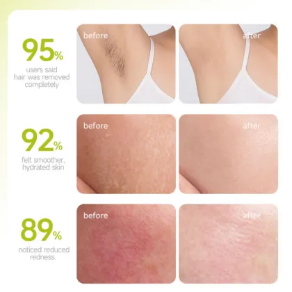 Moisturizing and Softening Body Hair Removal Cream