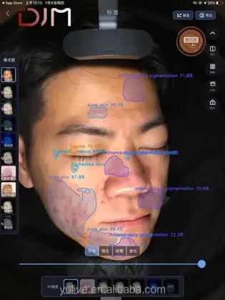 CE Certified AI Skin Analyzer Camera for Beauty Clinics