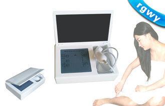 Pigmentation Removal IPL Skin Rejuvenation Machine For Body