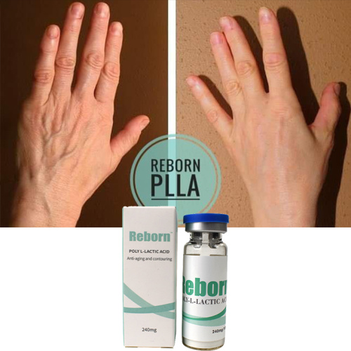 Moisturizing Reborn 500mg PLLA Filler