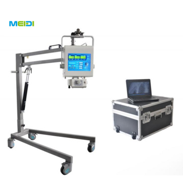 PORTABLE DIGITAL X- RAY MACHINE SYSTEM MODEL