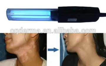 vitiligo therapy lamp home use for whole body
