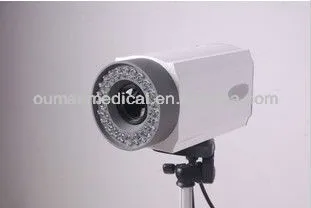 Medical device of Colposcope
