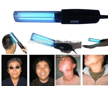 home use UVB therapy lamp---311nm vitiligo lamp