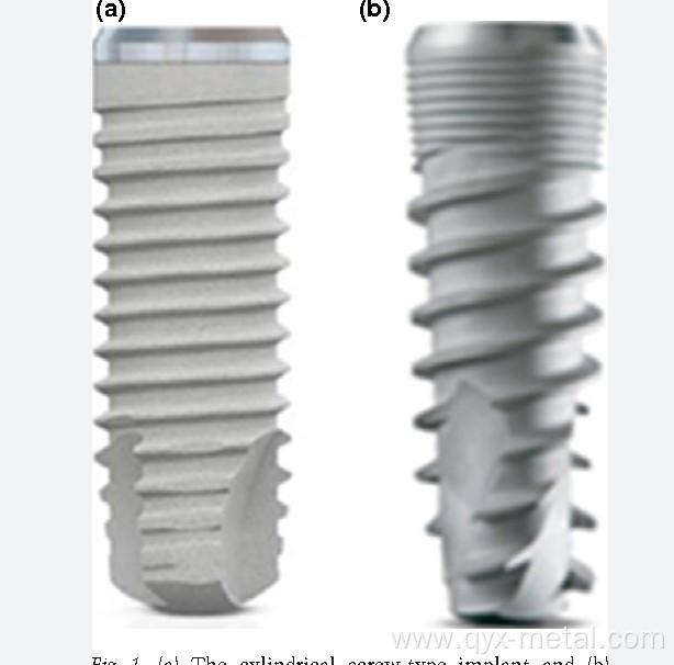 Implanted titanium alloy screw for surgical and dental