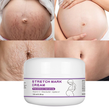 Wholesale 100ml Body Care Stretch Mark Removal Cream
