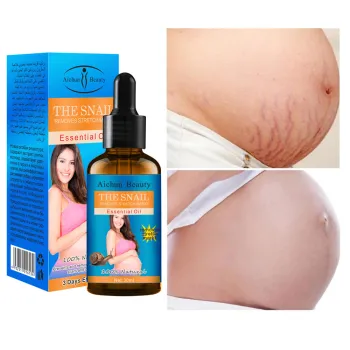 Hot Sale: 30ml Snail Oil for Stretch Mark Removal and Anti-Scars