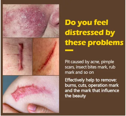 High Quality Crocodile Repair Gel: Scar Removal & Skin Care Cream