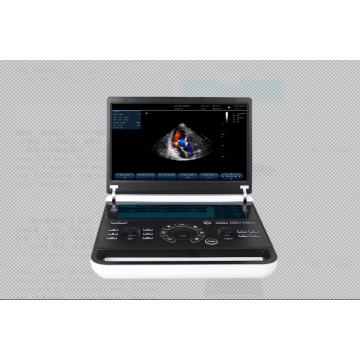 Renkli Doppler Tanısal Ultrason Sistemi(Revo9)