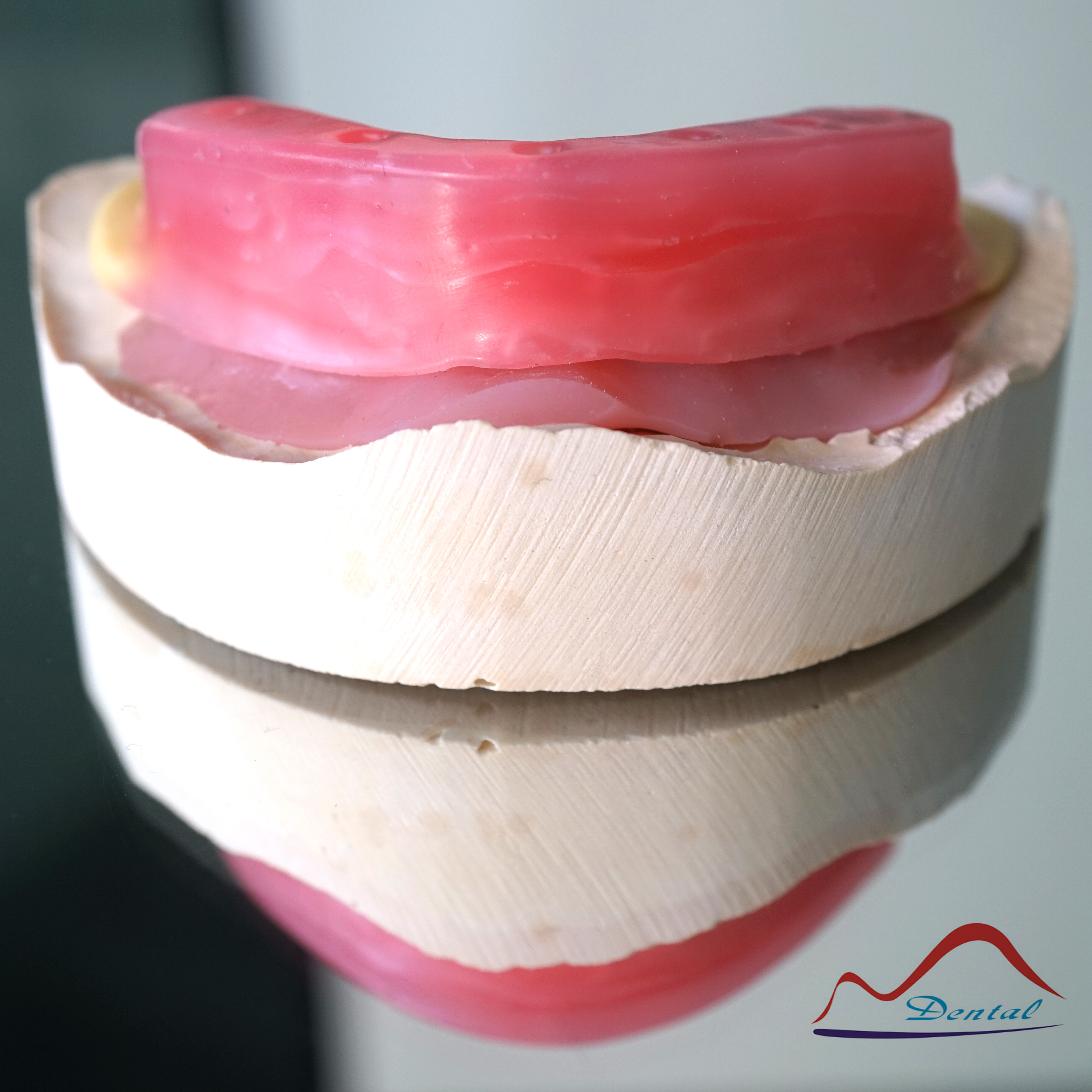 Implant Wax Rim Try In