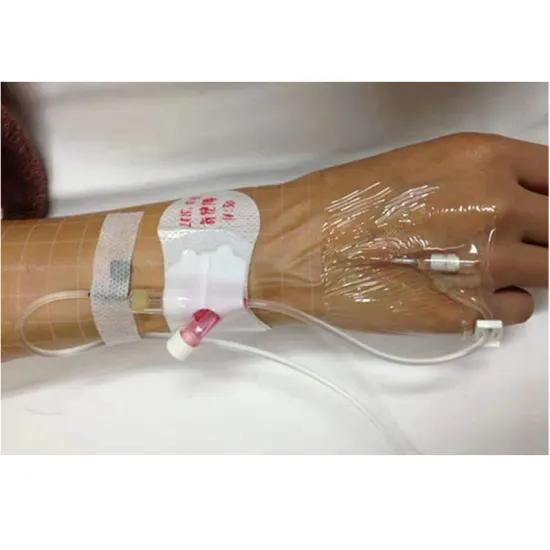 Hot Sale Indwelling Needle Fixation Dressing - Medical Securement Catheter Fixing Device