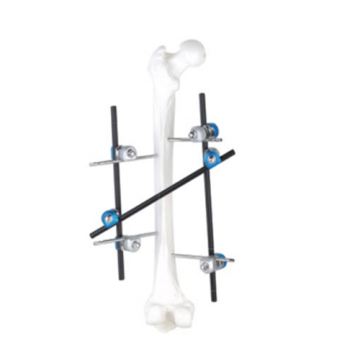 orthopedic external fixator Tibial Joint External Fixator