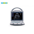 Portable 3D/4D Color Doppler Ultrasound Machine Digital Ultrasonic Diagnosis System for Human Use Medical Ultrasound Instruments