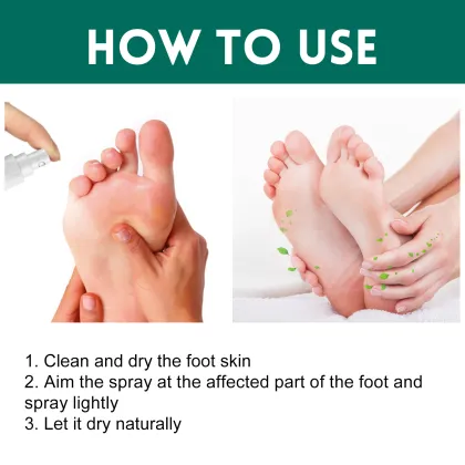 Ouhoe Skin Exfoliate Foot Spray: Odor Removal and Anti-Bacterial Relief