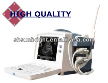 pc-based full digital ultrasound