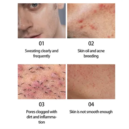OEM Organic Natural Anti-Acne Body Soap