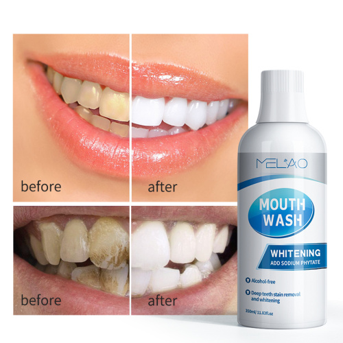 Whitening Teeth Total Care Anticavity Fluoride Mouthwash