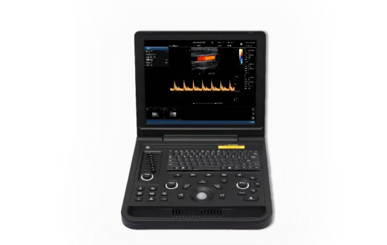 Krayson KC90 Color Doppler Ultrasound machine