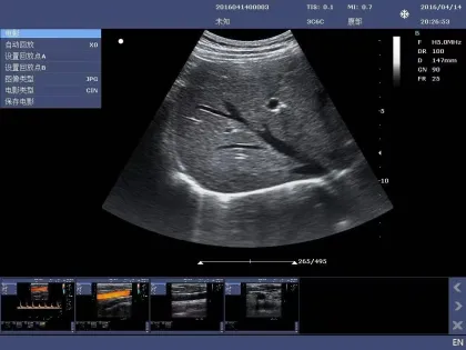 Krayson KR-C30 High-Performance Color Ultrasound Device
