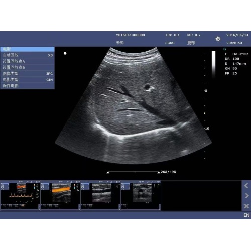 KPC-3C Convex Palm Doppler ультрагукавая сістэма