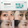 Richesse eye Darkeyes Pdrn Allsensa Hyaeyes