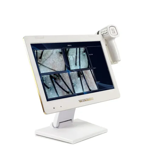 Professional Scalp Skin Analysis Software: Hair Follicle Detection and Analysis Scalp Analyzer Camera