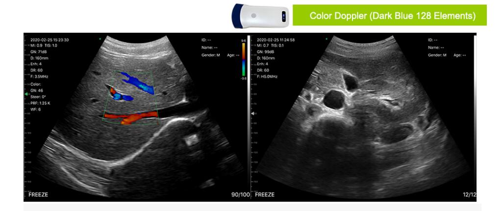 5c ultrasound