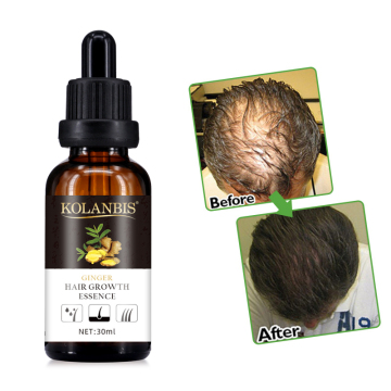 Wholesale OEM Hair Growth Oil for Hair Loss Treatment - Ready Stock for Men and Women