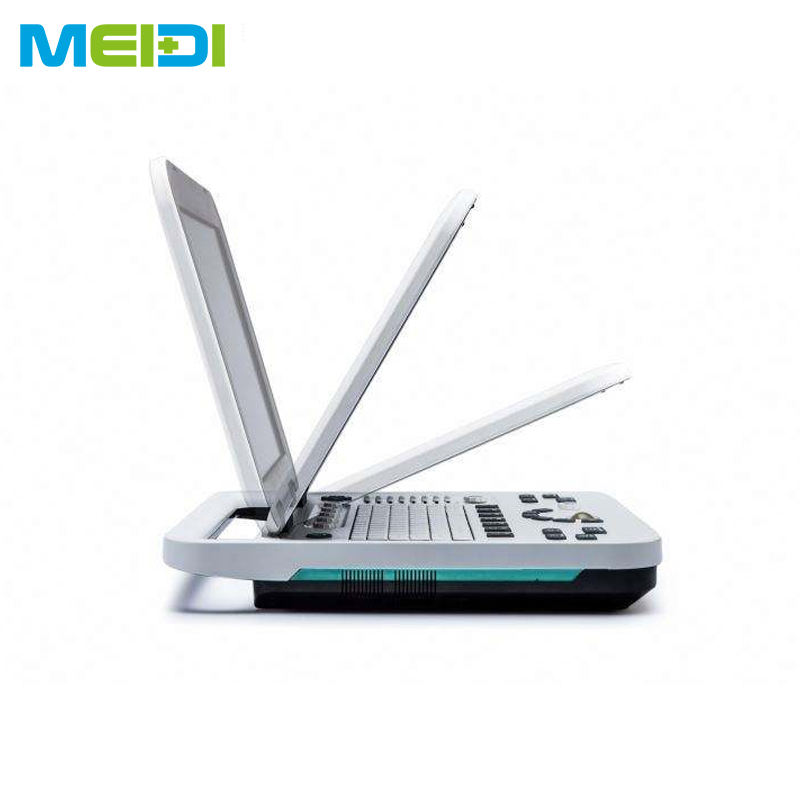 Full Digital Color Doppler Scanner Electric Metal Cheap Factory Medical Instrument for Laptop