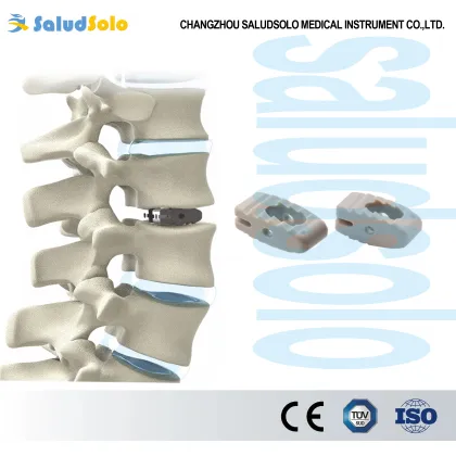 Spinal PLIF Peek Cages