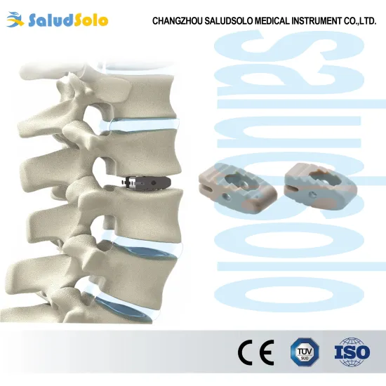 Spinal PLIF Peek Cages