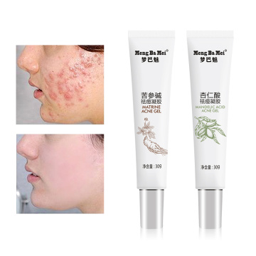 Gentle Repairing Anti Acne Facial Gel