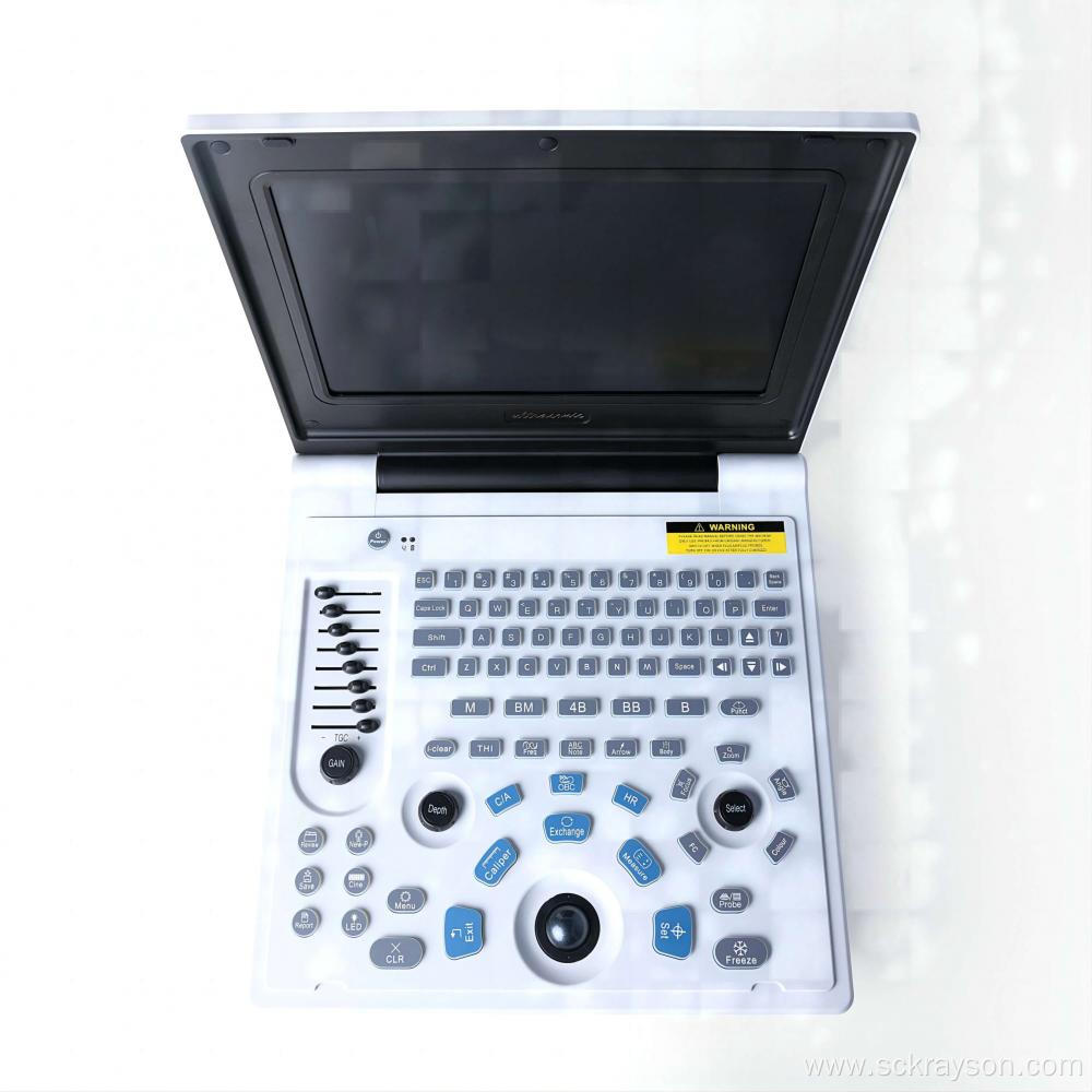 Silver Gradient Liver Ultrasound Diagnostic Equipment