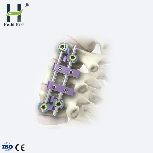 implantes de placa de titanio ortopédicos Spine series