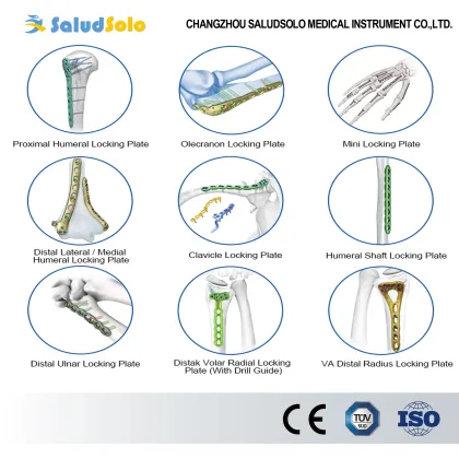 VA Distal Radius Locking Plate