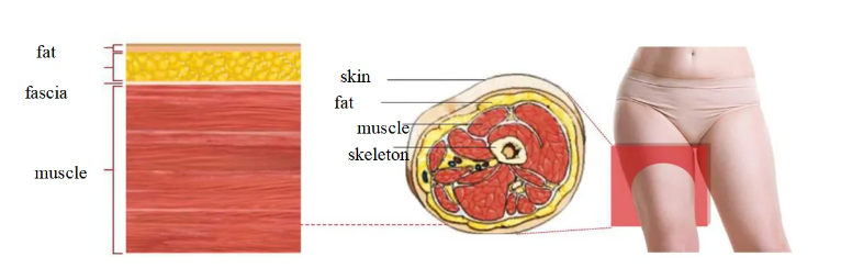 Advantage of Cryo Body Musle Slimming Machine