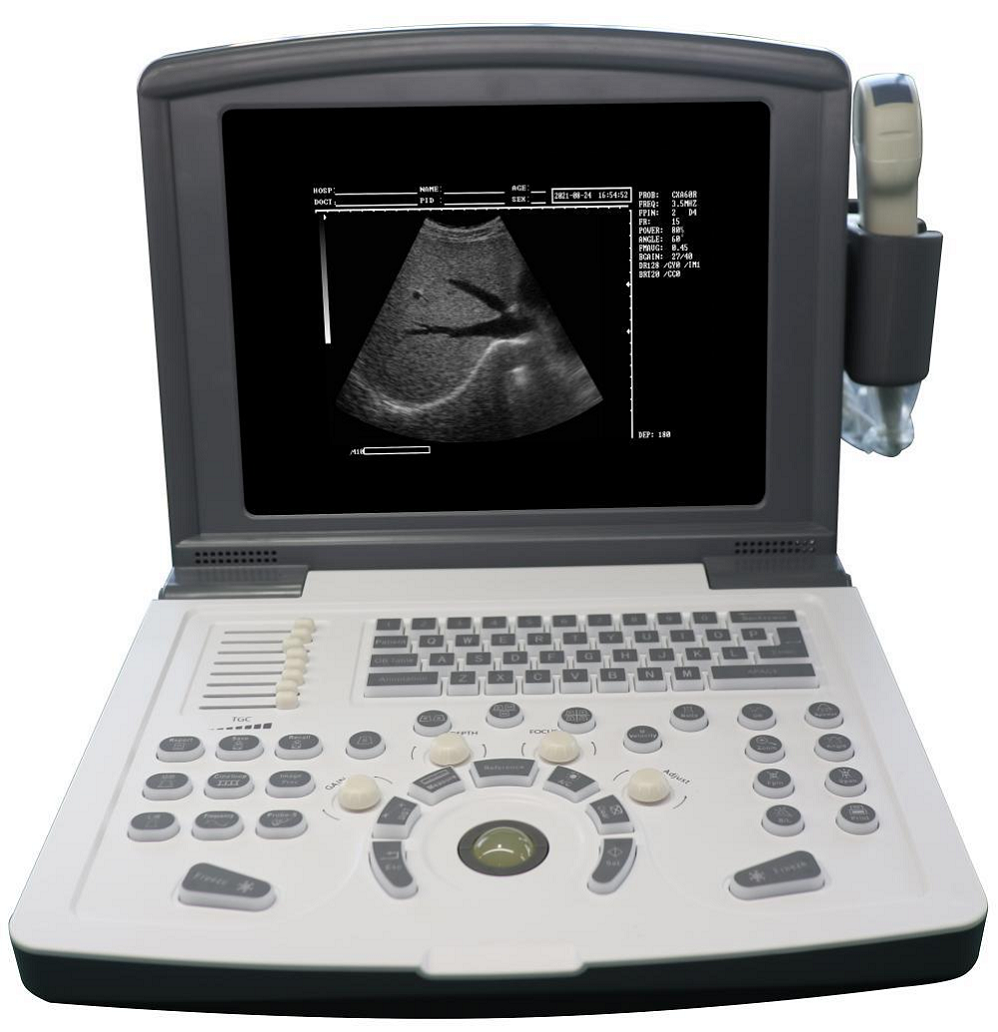 Cheap Portable black and white Diagnostic Ultrasound scanner