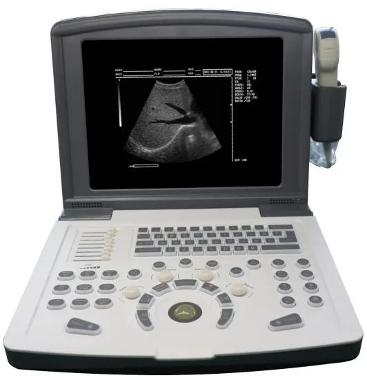 Cheap Portable black and white Diagnostic Ultrasound scanner