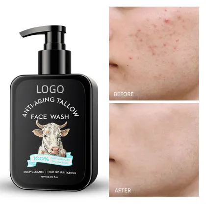 Natural organic men facial cleanser for removing acne