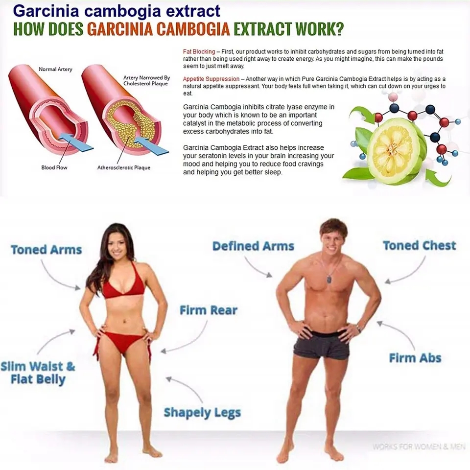 OEM/ODM Detox Weight Loss Gummies Green Coffee Extract Body Slimming Garcinia Cambodia Gummies