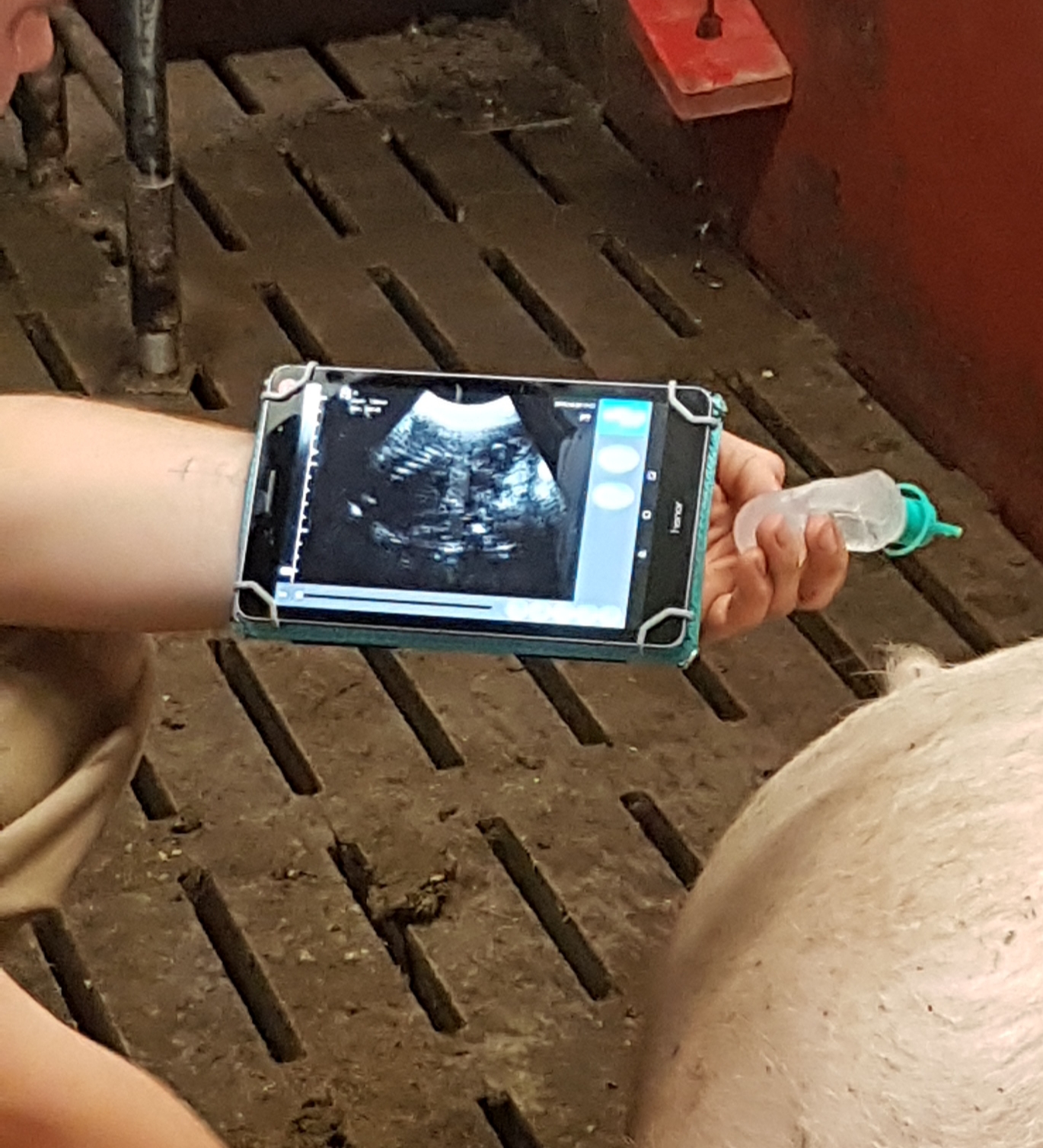 mobile ultrasound