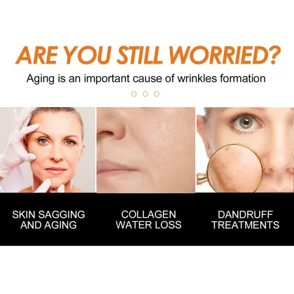 Turmeric Eye Cream: Instant Dark Circles, Puffiness & Wrinkle Removal