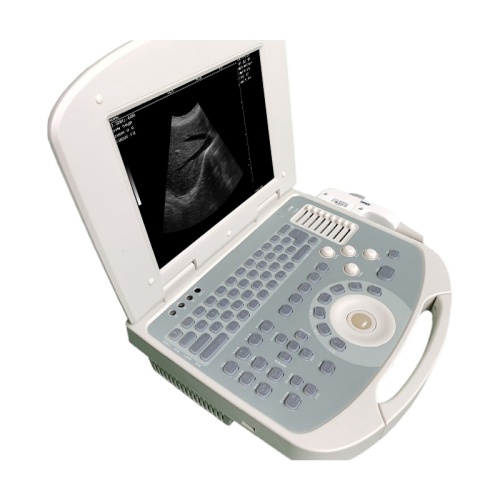 Laptop Digital Ultrasound Machine Scanner System for Clinic